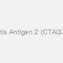 Cancer/testis Antigen 2 (CTAG2) Antibody